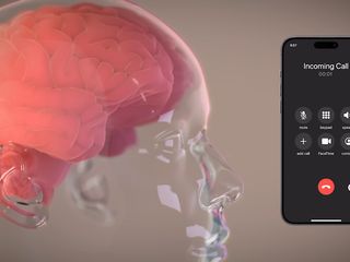 thumbnail - Prueba Neuralink